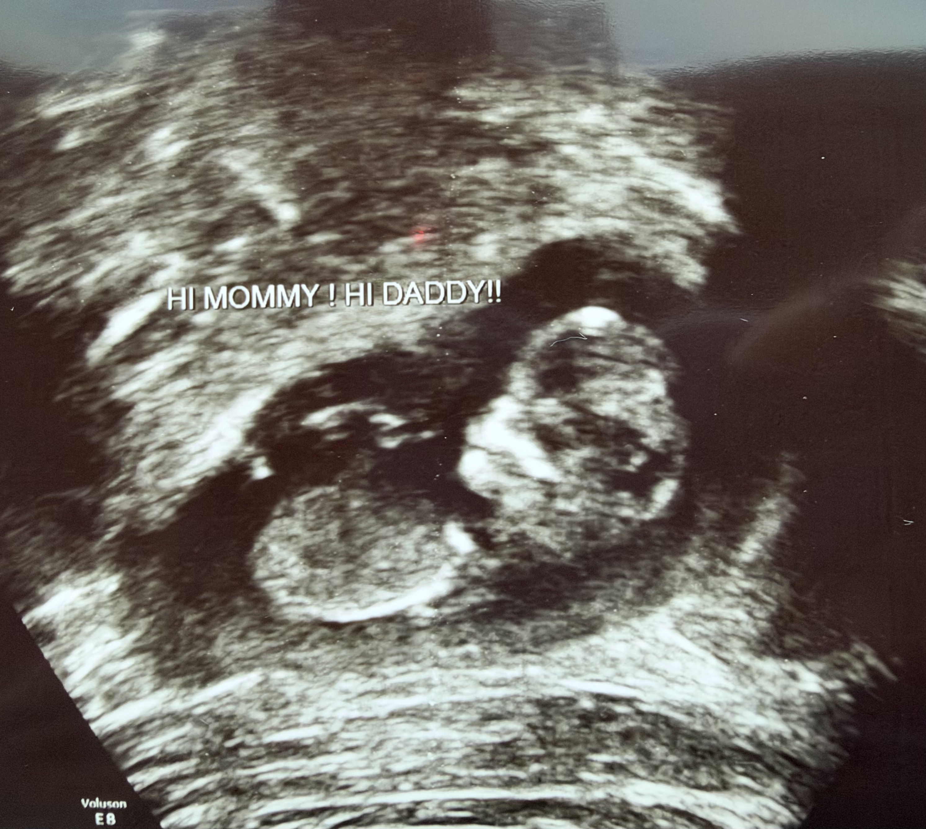Sonogram Scan 2